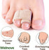 Welnove 6Pcs Hammer Toe Straightener, Cushioned Bandages for Correcting Hammer, Broken, Crooked & Overlapping Toes