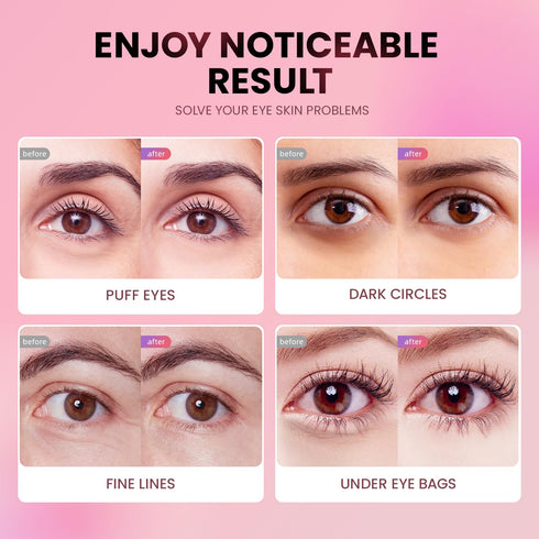 Under Eye Patches, 24 Pairs of Tri-color Glitter Gel Pads for Dark Circles, Puffy Eyes, and Wrinkles, Natural Collagen