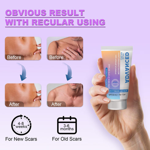 Voryn 1.23Oz (35g) Silicone Scar Cream Scar Gel - Advanced Scar Treatment Keloid Bump Removal for Surgical Scars