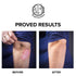 Keratosis Pilaris Exfoliating Body Lotion – 12% Lactic Acid for Gentle Exfoliation & Moisture