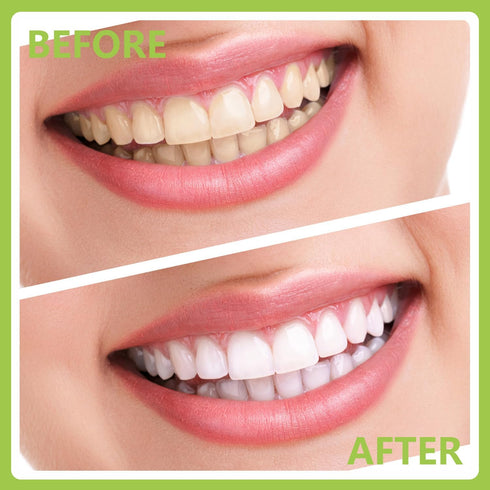 Dental Tools, Professional Teeth Cleaning Oral Care Hygiene Kit, Stainless Steel Dental Pick Tooth Scraper.