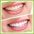 Dental Tools, Professional Teeth Cleaning Oral Care Hygiene Kit, Stainless Steel Dental Pick Tooth Scraper.