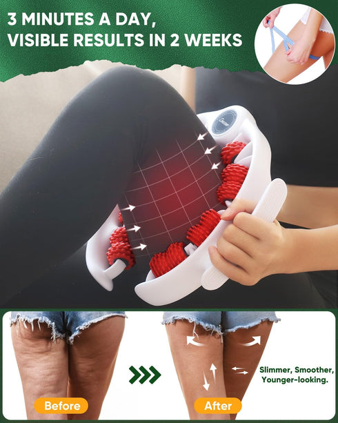 ONUEMP Cellulite Remover for Legs, Cellulite Massager Roller Muscle Roller, Fascia Massage Tool Thigh, Calf, Leg