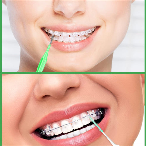 Zopeal 250 Pieces Braces Flossers, Interdental Brush for Cleaner Teeth, Soft Dental Picks