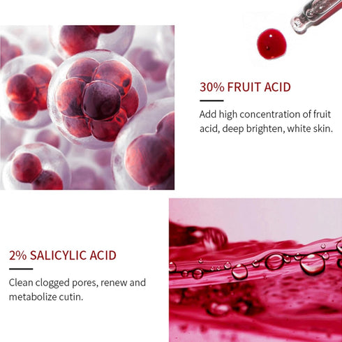 Peeling Solution AHA 30% + BHA 2% - Exfoliating Facial Serum Chemical Peel for Face, Reduces Blemishes and Fine Lines