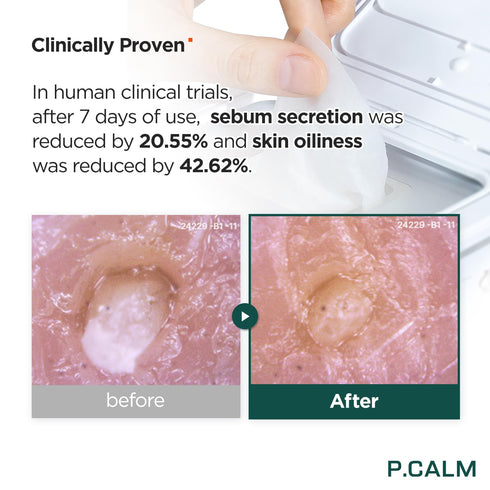 P.CALM Barrier Cycle Daily Sheet Mask Pack 30 Days - Korean Non Comedogenic Daily Moisturizing Treatment for Sensitive