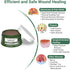 Perianal Repair Ointment: Treatments for Anal Fistula, Anal Fissure, Perianal Abscess, Rapid Relief from Pain, Burning