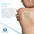 Dynarex DynaDerm Hydrocolloid Dressing, Sterile Moist Bandages, 2" x 2", Pack of 20, Latex-Free