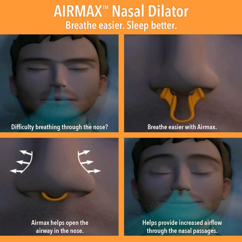 AIRMAX Medium Clear Nasal Dilator for Better Sleep, Comfortable Anti Snoring Device