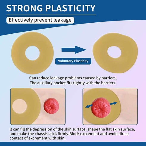 ovand 2 mm 10) Ostomy Barrier Rings - Ostomy Supplies - Thickness Moldable Ostomy Rings Medical Grade Hydrocolloid