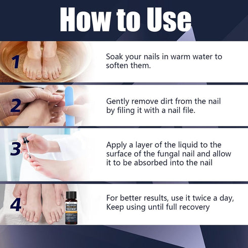 KISMIGER -1% 2 Toenail Fungus Treatment Extra Strength Tolnaftate, Bee Venom Nail Fungus Treatment, Gentle Fungal Nail