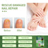 NOXYRAL 7 Toenail Fungus Treatment Extra Strength: Pure Natural Plant ExtractsToe & Fingernail Fungus Renewal - Nail