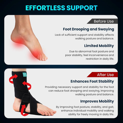 Welnove Foot Drop Support Brace, AFO Ankle Stabilizer for Improved Walking, Aiding Foot Control in Cases of Drop Foot