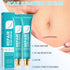 Nmoiat 2pcs Scar Cream for Men And Women, Scar Repair Cream, Skin Smoothing Firming, Skin Scar Removal Repair