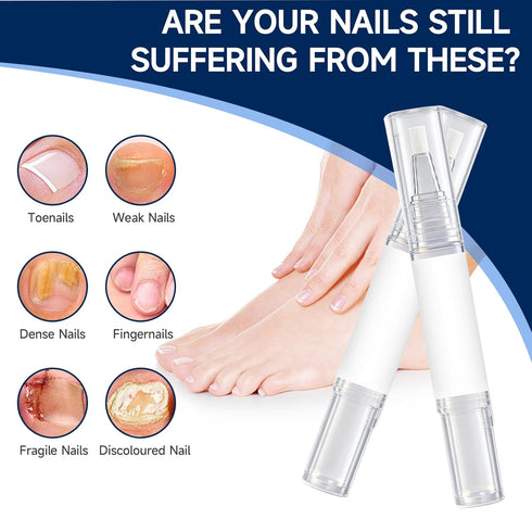 Nail Repair Pen with Lauric Acid and GlycerinStrengthens brittle nails, providing cooling relief for toenails