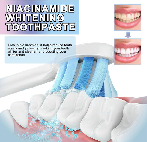 YG LianKai 2PC Niacinamide Toothpaste, Niacinamide Whitening Toothpaste, Intensive Nicotinamide White Teeth, Fresh