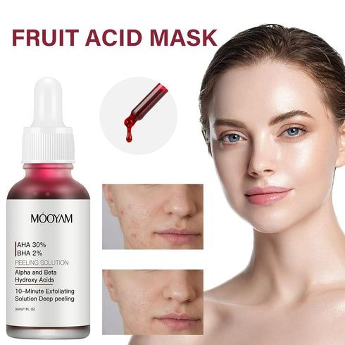 Peeling Solution AHA 30% + BHA 2% - Exfoliating Facial Serum Chemical Peel for Face, Reduces Blemishes and Fine Lines