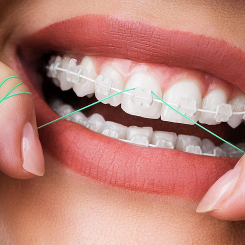 600 Pcs Dental Floss Threader for Bridges, Braces, and Implants, Multifunctional Nylon Loop Design, Pack of 12 (Green)