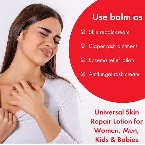 Natrulo Skin Repair Cream | Natural All Purpose Ointment for Eczema, Itch Relief, Bites, Burns, Diaper Rash, Ringworm, Wound Care | Repair Rescue Skincare Salve