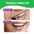 Orthodontic Rubber Bands for Braces, Premium Quality Elastic Teeth Rubber Bands, Heavy Force 4.5 oz, Neon
