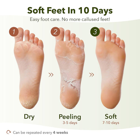 Purederm Shiny & Soft Foot Peeling Mask (3 pack) for Smooth Baby Skin, Exfoliating Calluses