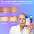 MISS SPA Forehead Silicone Anti-Wrinkle Patch - Reusable Hydrating Patches, Dermatologist Tested