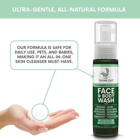 All Natural Face & Body Wash for Eczema, Psoriasis, Bug Bites, 7.1 oz Soothes Itching and Irritation