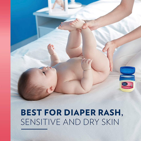 Vaseline Petroleum Jelly Baby Skincare, 4 Count, 13oz - Treats Dry Skin & Prevents Diaper Rash
