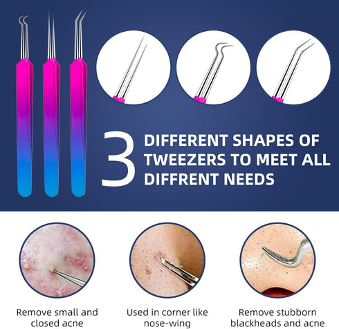 Ybaoo Pimple Popper Tool Kit - 10 Pcs Blackhead Remover Comedone Extractor with Metal Case for Quick Removal