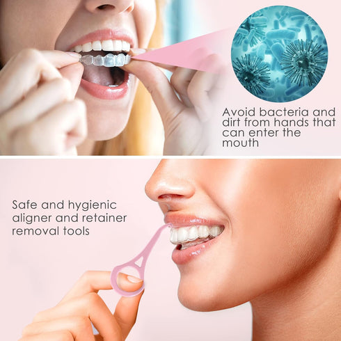 ARGOMAX Aligner Removal Tool, 2 Retainer Remover Tools for Braces, Trays, Retainers, Dentures (Pink)