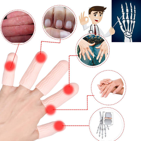 Finger Cots, Gel Finger Tips Protector, Finger Covers (14PCS, L size) - New Material (Latex-Free) for Finger Cracking,