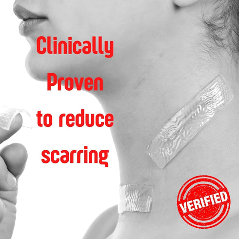 SilverSeal Burn and Wound Dressing - Hydrogel Pads with X-Static Silver, Soothing Moist & Protective for Burns, Cuts &