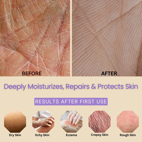 Lavender Body Lotion for Dry Sensitive Skin, 8oz - Eczema Relief Moisturizer with Aloe Vera