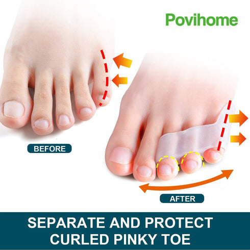 Povihome 10 Pack Pinky Toe Separator and Protectors, Triple Gel Toe Separators for Overlapping and Curled Toes