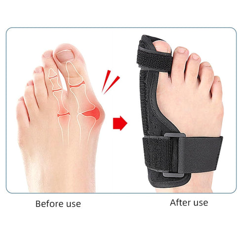Bunion Corrector Big Toe Straightener Hammer Toe Bunion Pain Relief Hallux Valgus Corrector Bunion Splint Bunion Pads Toe Brace Right+Left