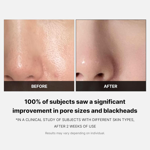 Medicube Zero Pore Pads 2.0 - Dual-Textured Facial Toner Pads for Exfoliation, Minimizing Pores, 4.5% AHA & 0.45% BHA,