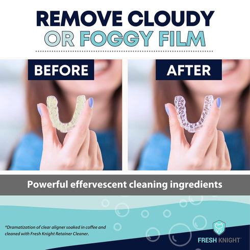 Retainer Cleaner, Denture Cleaner (120 Tablets) Brightens and Freshens Clear Aligners, Retainers, Dental Appliances