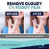 Retainer Cleaner, Denture Cleaner (120 Tablets) Brightens and Freshens Clear Aligners, Retainers, Dental Appliances