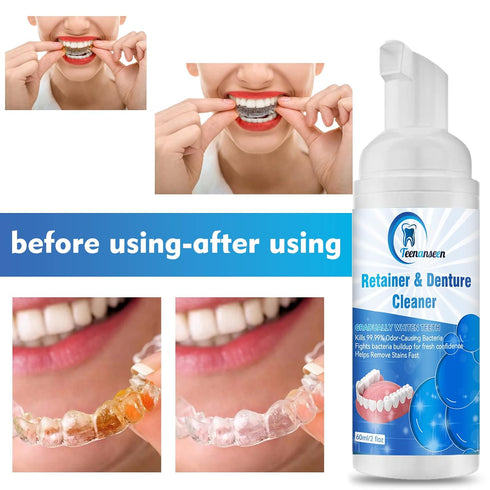 Aligner Cleaner and Denture Whitener Paste Foam, Fast-Acting Alternative to Retainer Cleaner Tablets, 2 Pack