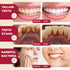 2 Pcs Sp-6 Probiotic Ultra Whitening Toothpaste, Deep Cleaning Care, Stain Removing, Fresh Breath
