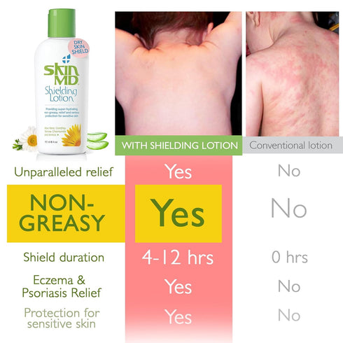 Skin MD Shielding Lotion 4oz, Hydrating Non-Greasy Protection for Sensitive Skin