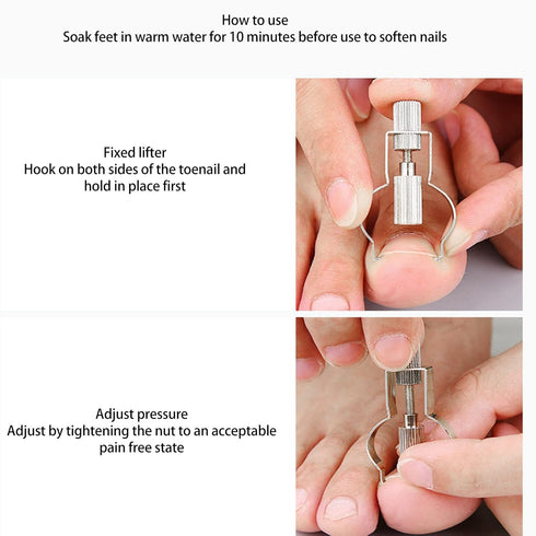Ingrown Toenail Lifter Tool, Stainless Steel Clamp for Ingrown Toenail Care, Professional Foot Care Tool, Silver