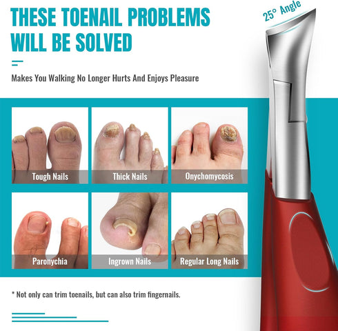 Toenail Clippers for Thick Nails - Heavy Duty Kit with Long Handle for Seniors and Elderly, Professional Nail Clippers