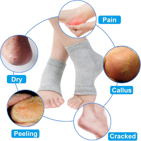 Vented Moisturizing Gel Heel Socks, 3 Pairs Toeless Spa Sock for Foot Care Treatment, Grey, Cracked Heels & Dry Feet