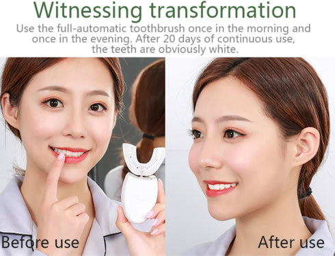 VIDECOR 360 Adult Smart U Shape Degrees Sonic Electric Toothbrush Silicone Automatic Travel U-Shaped Toothbrush,Blue