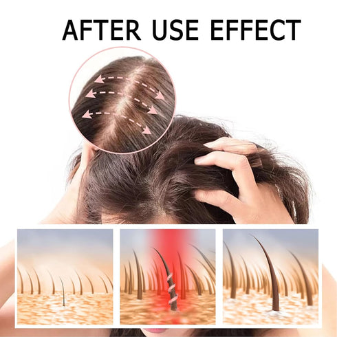 2 Box Ginger Plant Extract Anti-Hair Loss Shampoo - Ginger Shampoo for Hair Growth, 400g