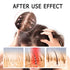 2 Box Ginger Plant Extract Anti-Hair Loss Shampoo - Ginger Shampoo for Hair Growth, 400g