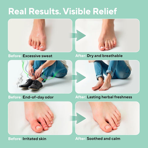 Lavinso Athletes Foot Care Spray with Tea Tree Oil Shoe Deodorizer & Foot Odor Eliminator for Smelly Feet Deodorant