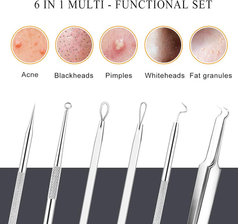Pimple Popper Tool Kit (6 Pcs) - Blackhead Remover Comedone Extractor Tool Kit with Metal Case for Facial Care