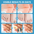 RHAICARE Remover(24 Count),Corn 40% Corn removers for Toes feet Bottom of Foot Corn Pads Remover for Toes feet